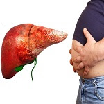 The Truth about Your Liver and Belly Fat