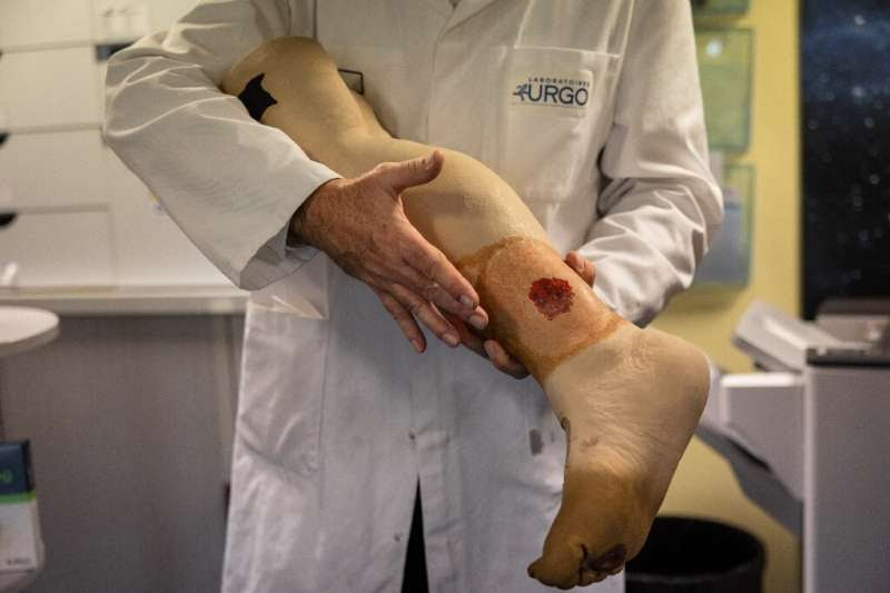 An Urgo researcher shows a wound that could be treated by an artificial skin