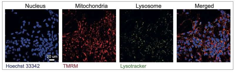 Scientists harness the power of AI to shed light on different types of Parkinson's disease