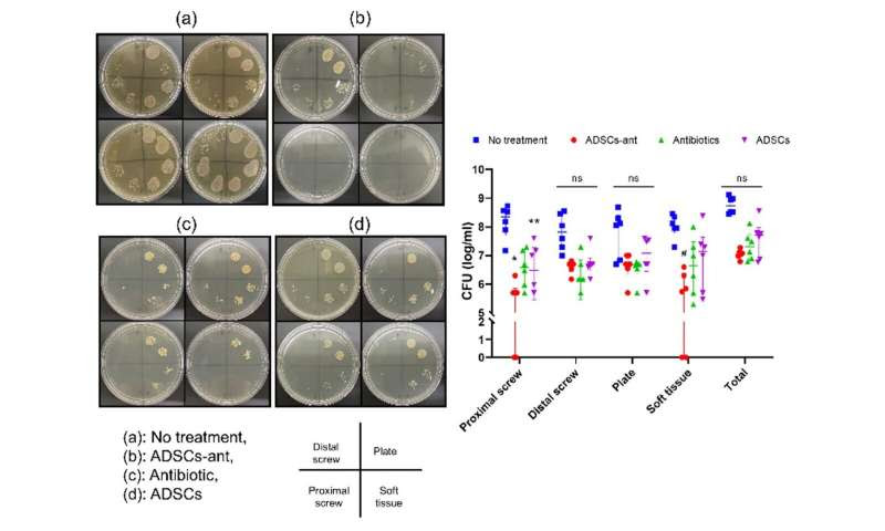 Coupling antibiotics with stem cells to fight off bone infections