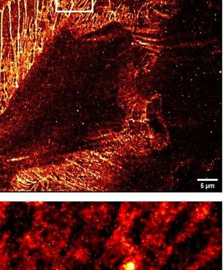 Blood vessel inflammation could be switched off by new molecule