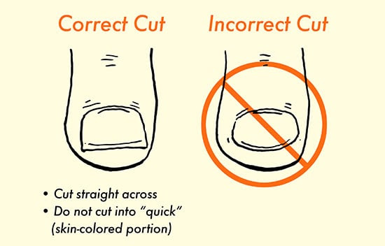 how to properly cut toenails illustration diagram
