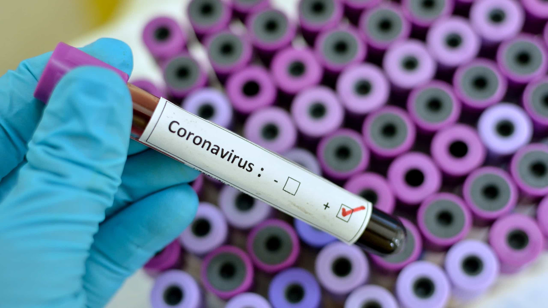 Período de incubação de novo coronavírus pode durar até 24 dias