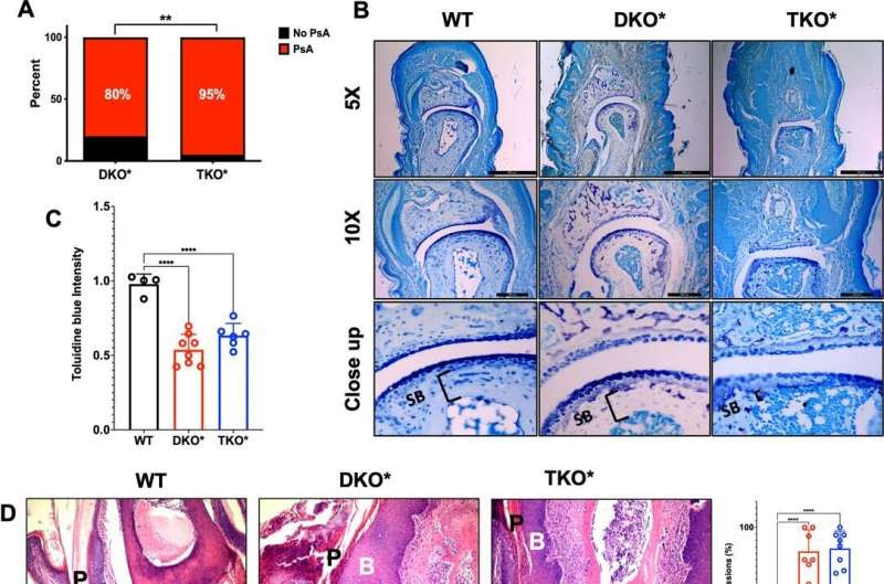 Study lays foundation for new psoriasis treatment strategy