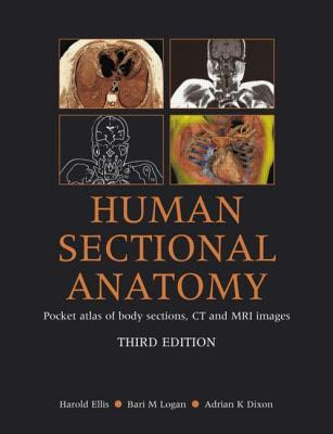 Human Sectional Anatomy: Pocket Atlas of Body Sections, CT and MRI Images in Kindle/PDF/EPUB