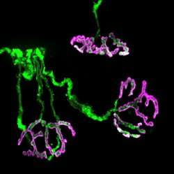 Researchers from Tel Aviv University identified the biological mechanism causing nerve destruction in the Motor Neuron disease A