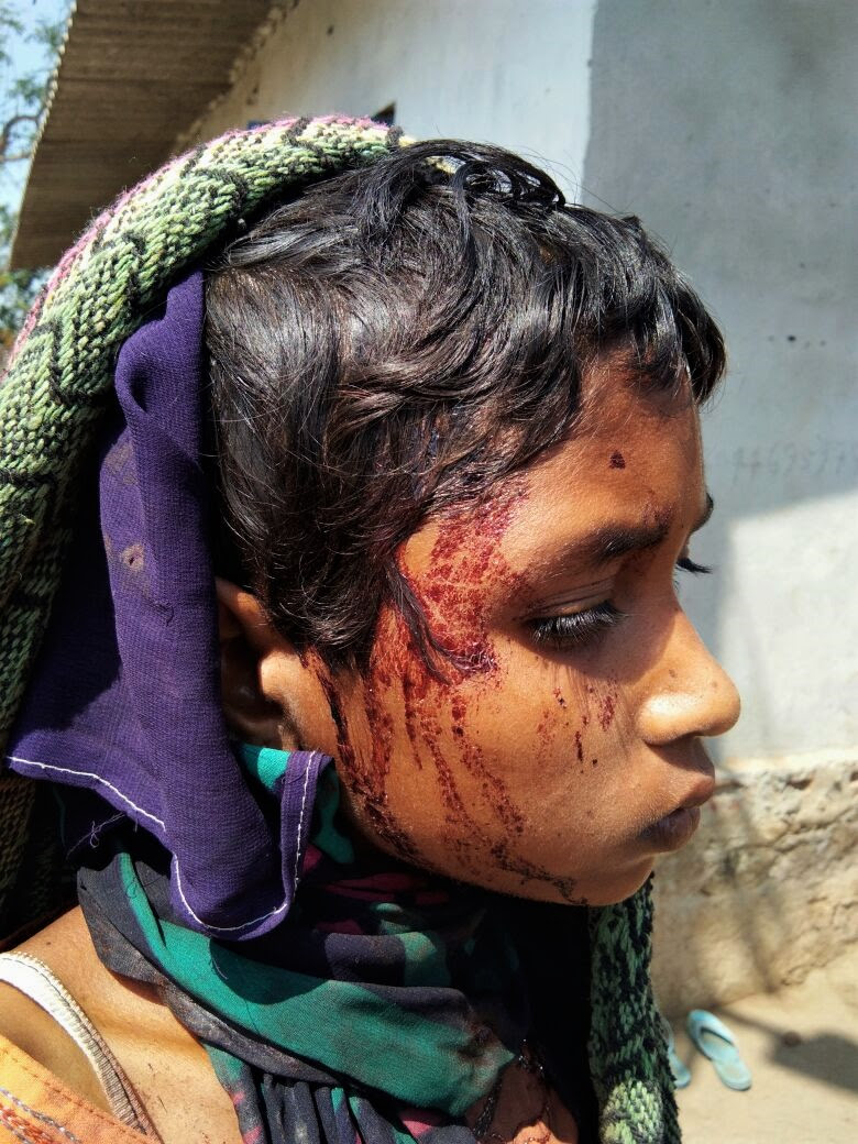  Mob beat Savita Madkami, 13, when she tried to rescue her mother. (Morning Star News)