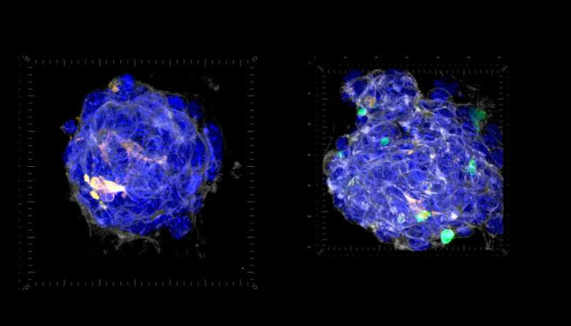 Study on tumor/immune cell interaction could impact cancer immunotherapies