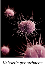 Neisseria gonorrhoeae