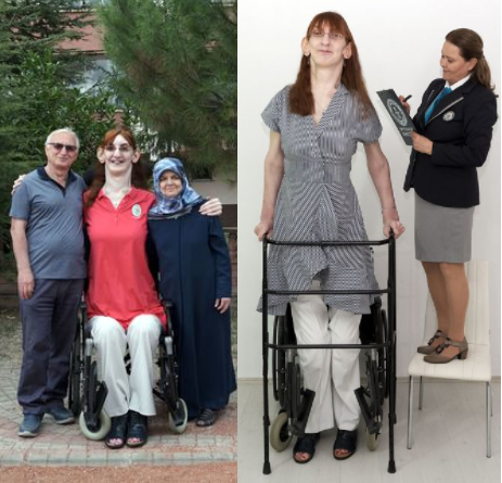 Guinness World Records crowns 24-year-old woman over 7ft as