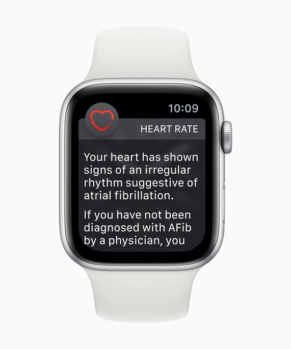 Apple Watch face with irregular heart rhythm notification.