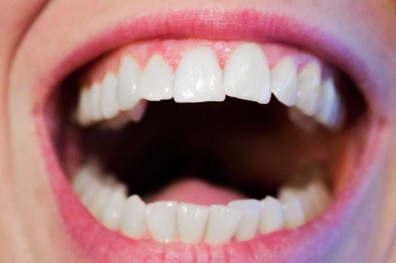 gum mouth