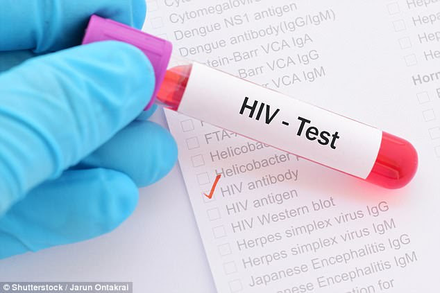 HIV tests give false negative results for up to seven months (stock)