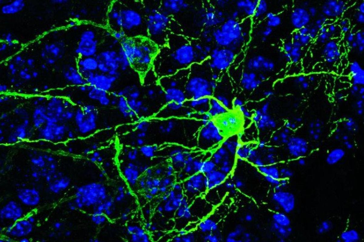 Pnoc neurons (green) have now been linked to physiological fear responses, and could be a potential target for new anxiety treatments