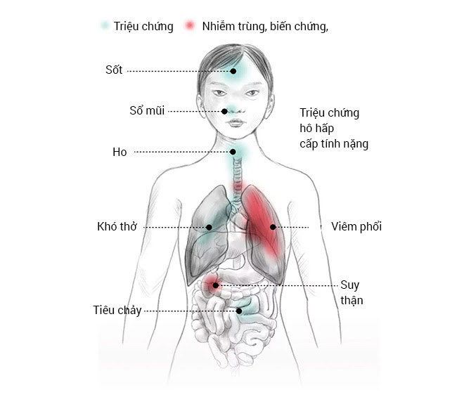 Những người tuyệt vọng ở Vũ Hán và đại dịch Corona nhìn từ đồ họa trực quan - Ảnh 22. Những người tuyệt vọng ở Vũ Hán và đại dịch Corona nhìn từ đồ họa trực quan - Ảnh 22.