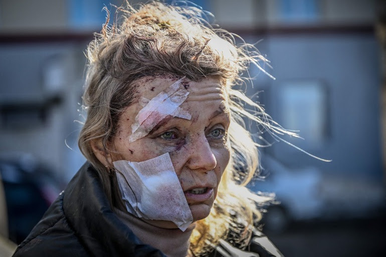 Ukraine tan hoang trong mưa bom bão đạn - Hình 8