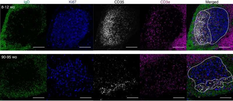 'Lost' immune cells partly to blame for reduced vaccine response in older people