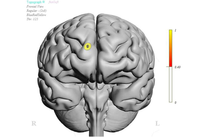 Long COVID linked to lower brain oxygen levels, cognitive problems and psychiatric symptoms