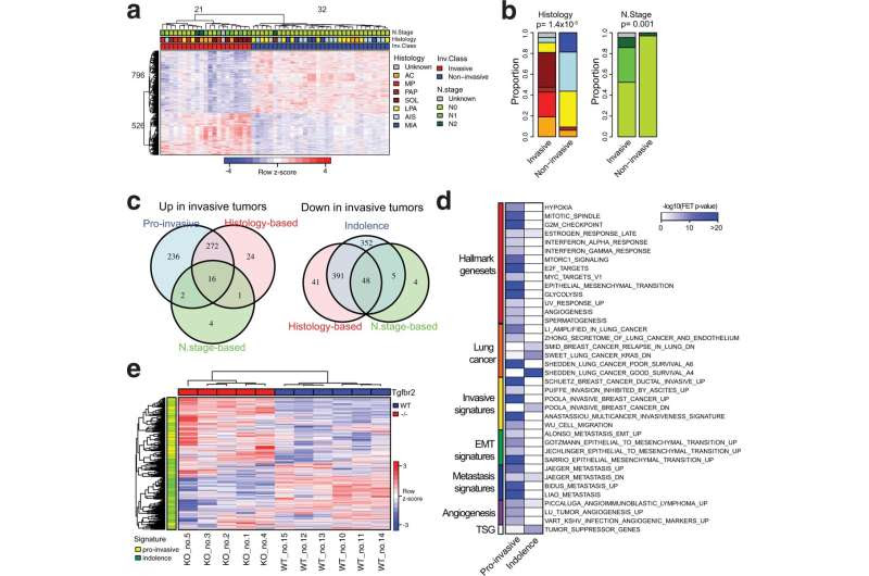 Researchers develop novel method to identify and treat aggressive early-stage lung cancers