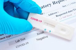Las pruebas diagnósticas de la COVID-19