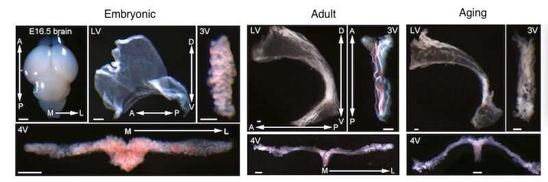 An 'atlas' of the brain's choroid plexus across the lifespan