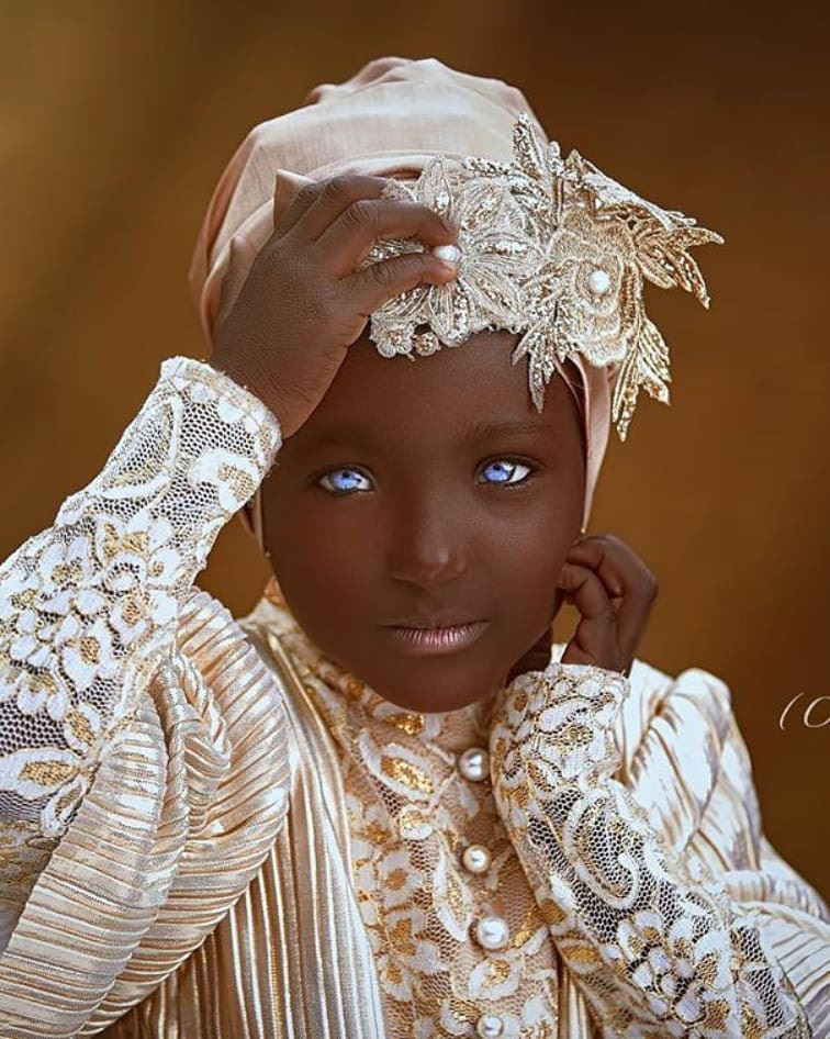 Blue-eyed Kwara woman makes peace with her husband as they team up for a lovely photo shoot