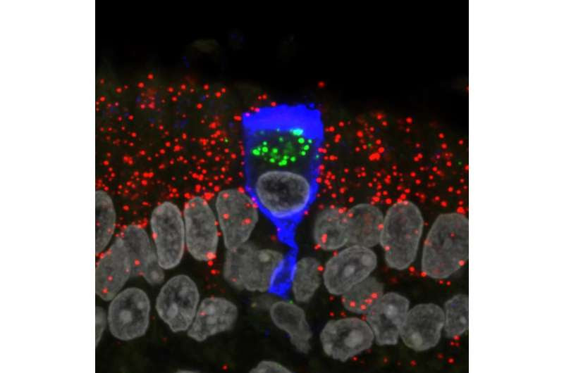 SARS-CoV-2 infects sustentacular cells in the olfactory epithelium of COVID-19 patients