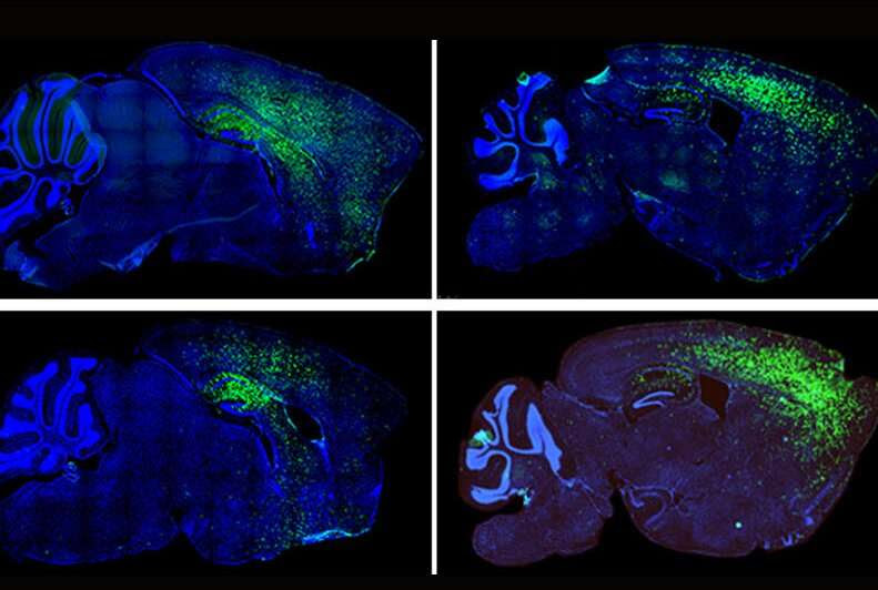 Some autism spectrum disorder symptoms linked to astrocytes