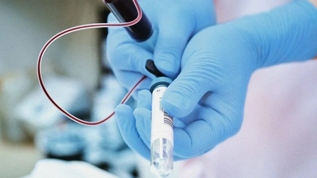 Nurse injecting blood from a syringe into a test tube for examination