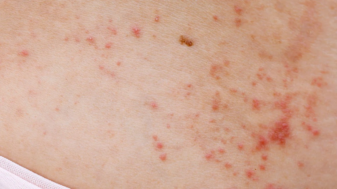 small pinpoint red dots on skin