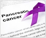Specific protein negatively affects pancreatic cells and leads to cancer growth