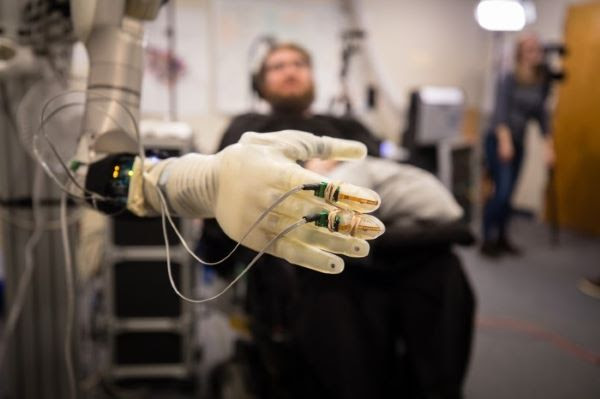 Una mano artificial controlada mentalmente. foto Pitt-UPMC