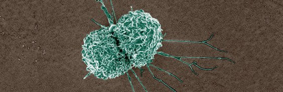 Microscopic image of immune cell.