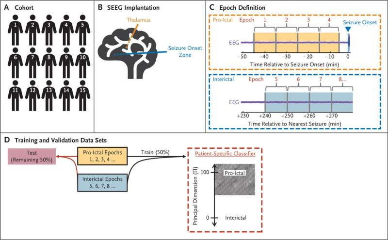 Study: Seizures can be predicted more than 30 minutes before onset in patients with temporal lobe epilepsy