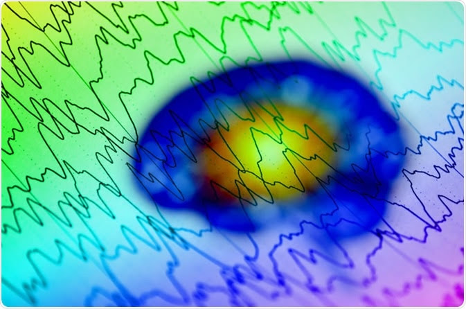 Brain wave on electroencephalogram EEG. Image Credit: Chaikom / Shutterstock