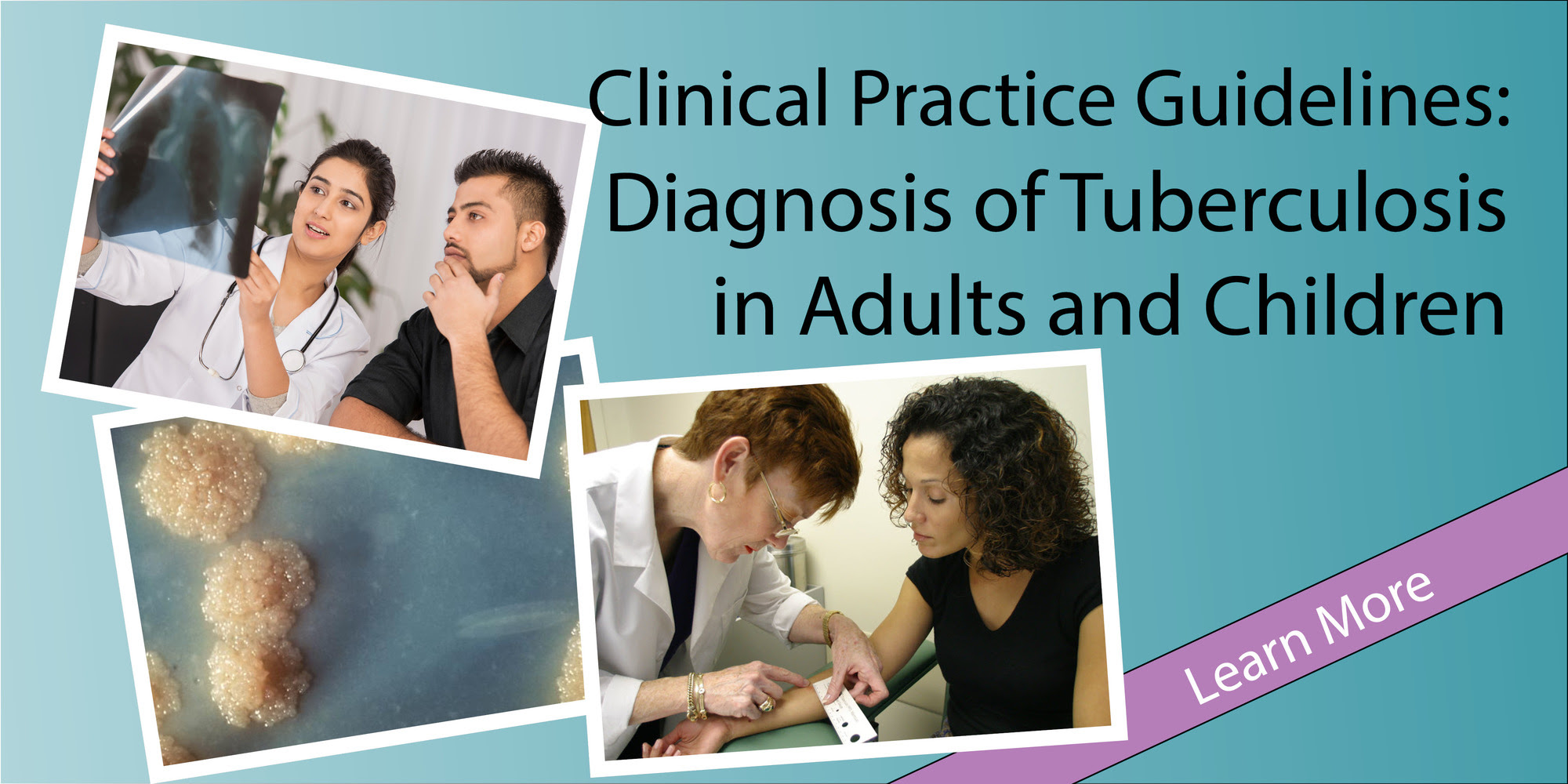 TB Diagnostic Guidelines