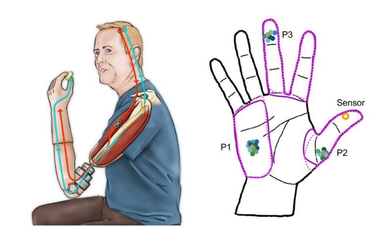 Even after long-term exposure, bionic touch does not remap the brain