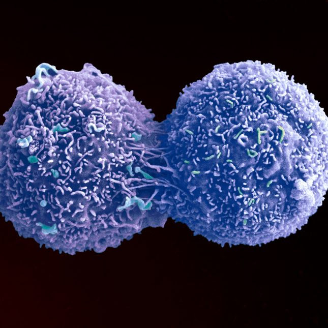 Lung cancer cell dividing