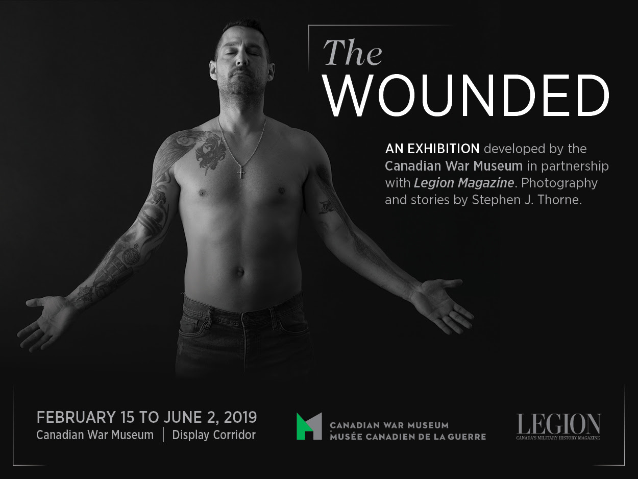 The Wounded Exhibition 