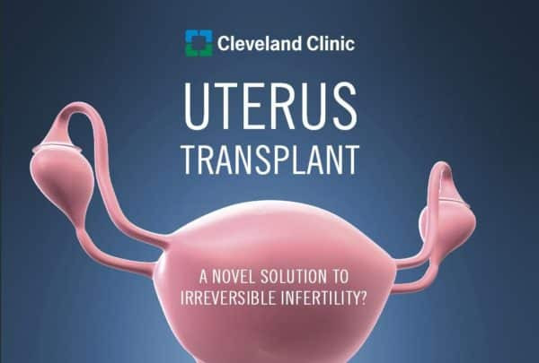 Until now it was used live donors Now a deceased donor uterine transplantation has been successfully performed. Video describing the essential steps process