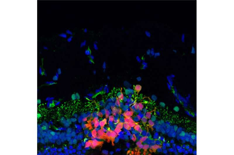 Progress toward a stem cell–based therapy for blindness