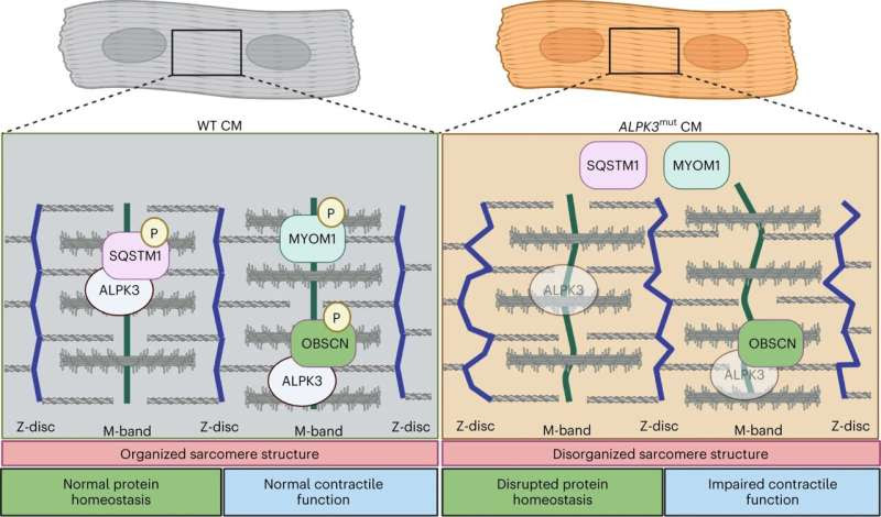 Researchers uncover how gene that increases risk of genetic heart disease works, paving way for new treatments