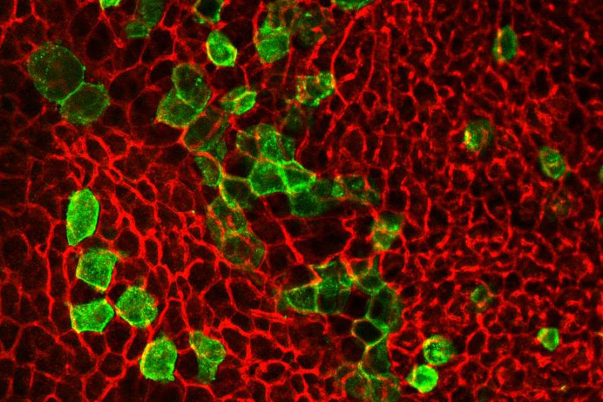 Brown fat cells derived from cells expressing the Trpv1 receptor, seen in green, have opened up interesting new pathways for the treatment of obesity