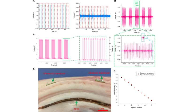 Simultaneous acoustic energy transfer and communication in neuroscience and cardiovascular medicine