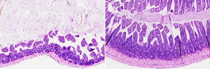 Salk scientists develop compound that reverses gut inflammation in mice