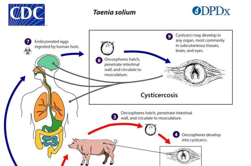 The diagnosis of neurocysticercosis