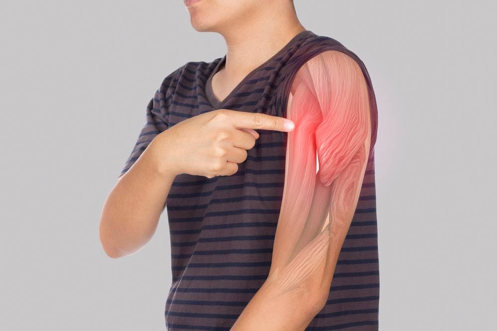 7 Causes of Pain in the Upper Arm - AICA Atlanta