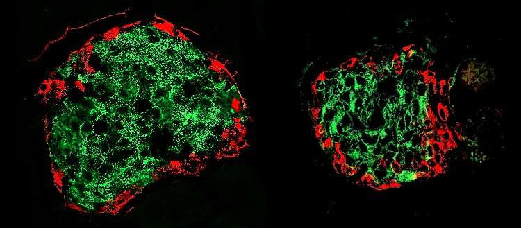 Detecting diabetes among people at risk