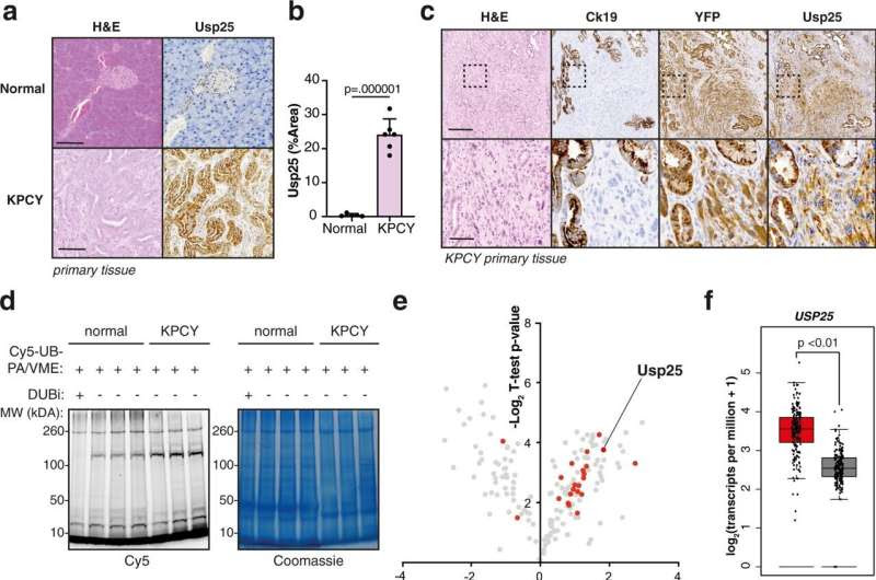 Drugs targeting cell recycling could be used to suffocate cancer cells