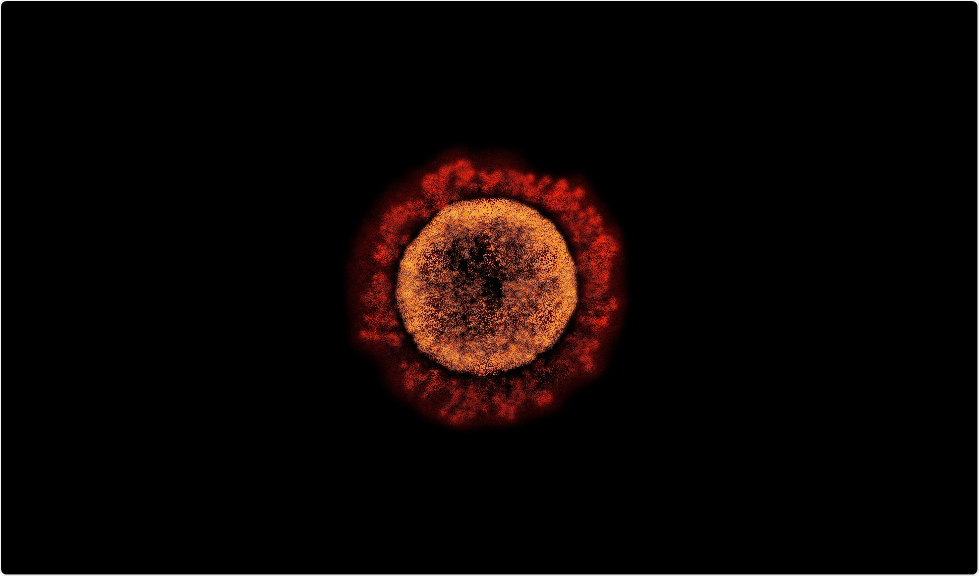 Study: INO-4800 DNA Vaccine Induces Neutralizing Antibodies and T cell Activity Against Global SARS-CoV-2 Variants. Image Credit: NIAID